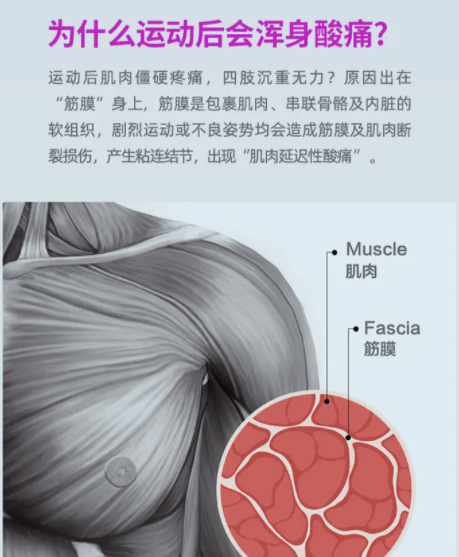 筋膜槍，是放松神器還是健康隱患？揭秘其真實(shí)效用與四大潛在風(fēng)險